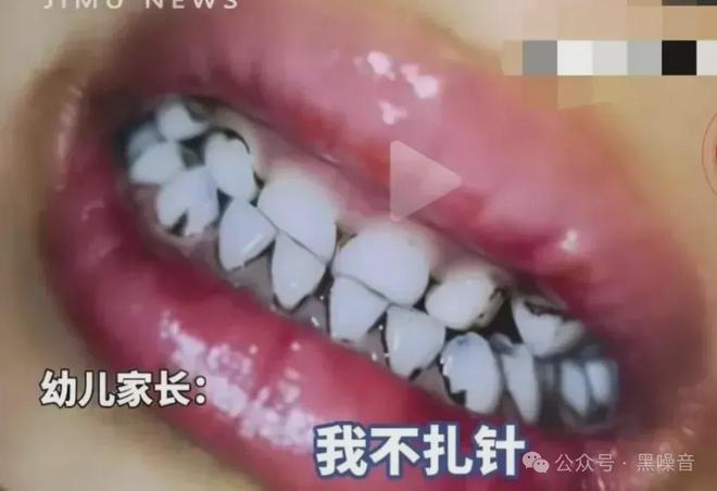 园铅中毒真相到底是什么？k8凯发国际登录天水幼儿(图5)